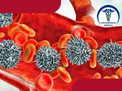 Leucemia mieloide cronica